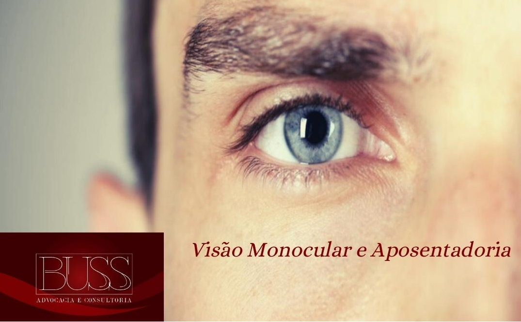 Vis O Monocular E Aposentadoria Buss Siementcoski Advogados Associados